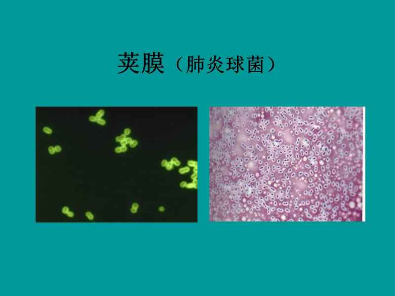 莢膜染色法