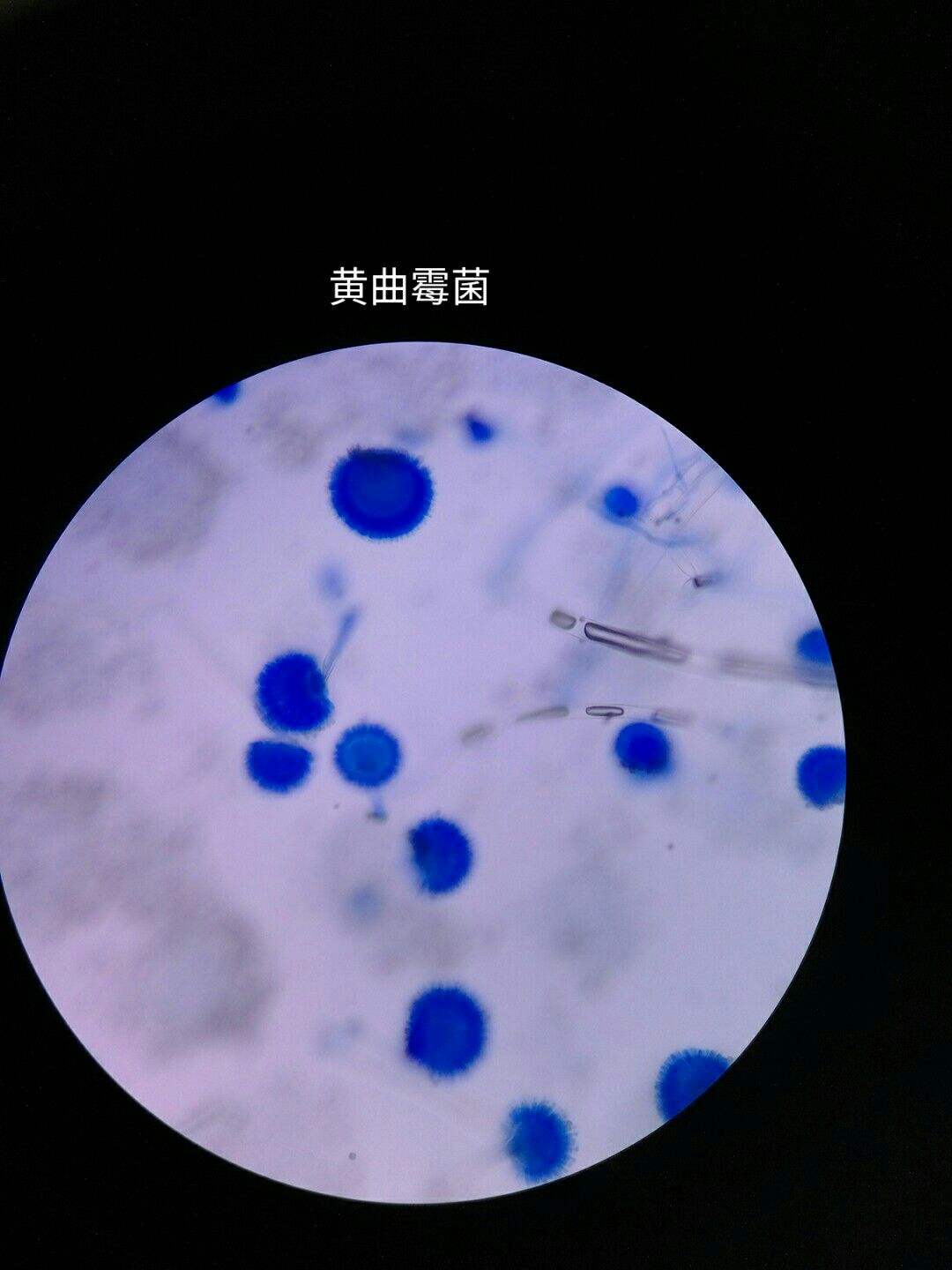 乳酸酚棉藍(lán)染色法