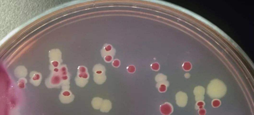 加TTC檢測(cè)菌落總數(shù)