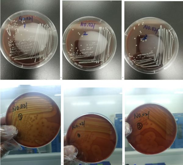 1號樣品溶血情況