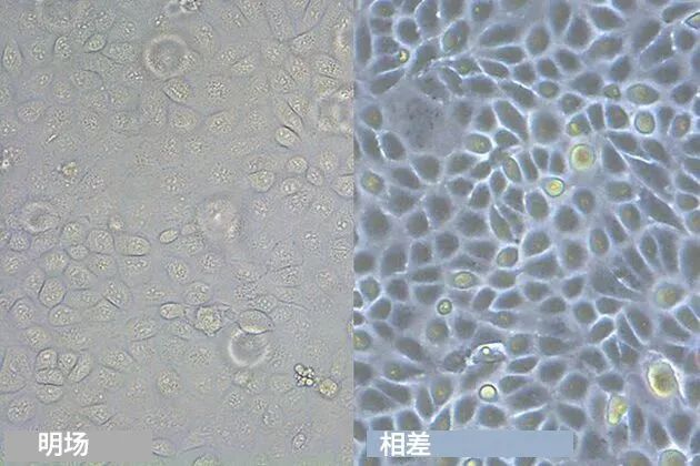 較狗腎臟細(xì)胞在明場照明和相差圖像中的顯示效果